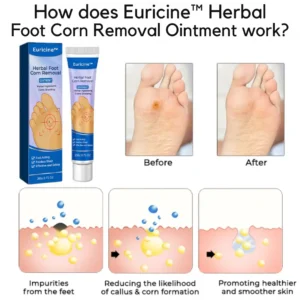 Euricine™ Herbal Foot Corn Removal Ointment