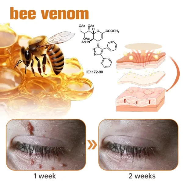 Fivfivgo™ WartGone Bee Venom Treatment Patch