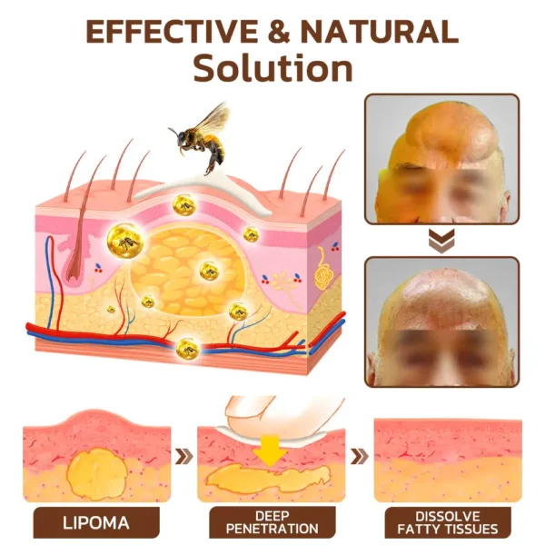 GFOUK™ Maryanni Bee Venom Lymphatic Recovery Cream