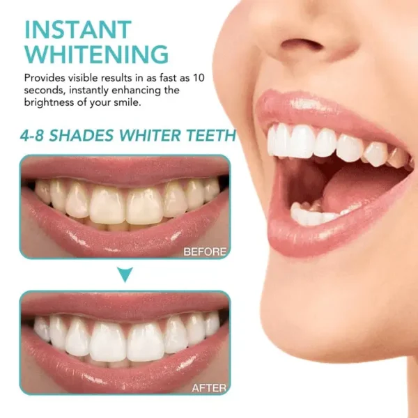 Oveallgo™ Instant Teeth Whitening Paint