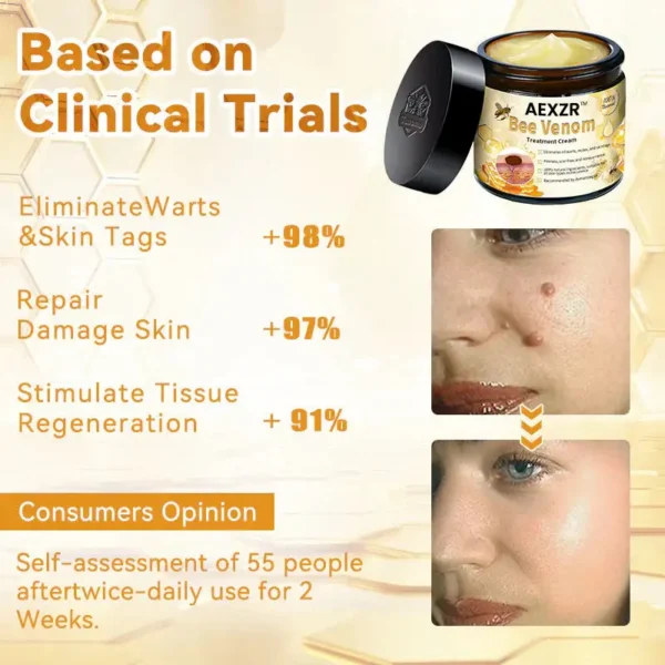 AEXZR™ Bee Venom Skin Treatment Cream