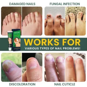 AEXZR™ Nail Care Anti Fungal Cream