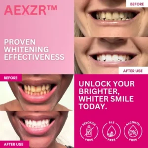 AEXZR™ Teeth Whitening Patches