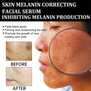 AQA™ Melanin Correcting Brightening Serum