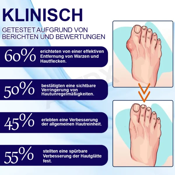 ATTDX™ Gicht Beruhigungs Kräuter Gelenk Entlastungspflaster