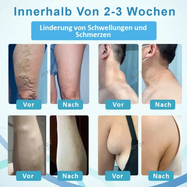 ATTDX™ LumpenKlar Lymphunterstützungs Roll-On