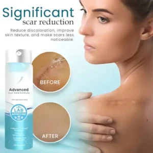 Advanced Scar Care Formula