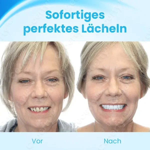 Ceoerty™ FlexYoSmile Silikon-Prothesen-Set