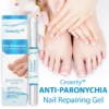 Ceoerty™ Anti-Paronychia Nail Repairing Gel