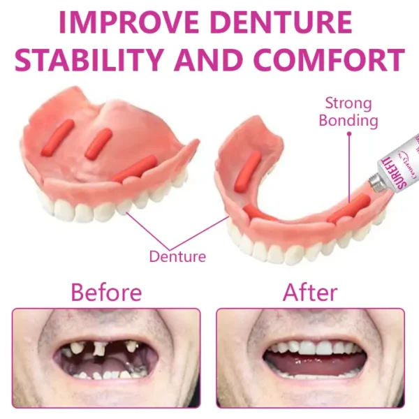 Ceoerty™ SureFit Thermal Denture Adhesive