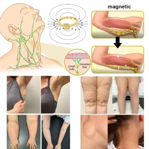 DIYSTAR™ Lymphvity MagneTherapy Germanium Ring