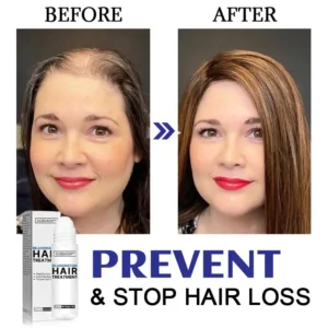 Dobshow™ Hair Rejuvenation Treatment