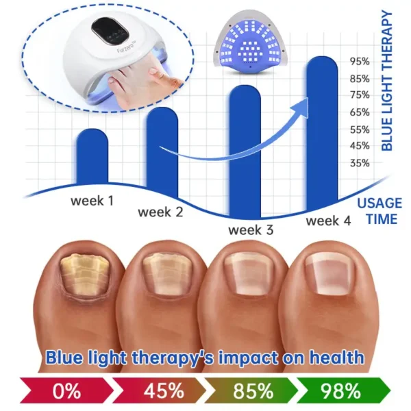 Furzero™ Advanced PureNail Fungus Laser Device