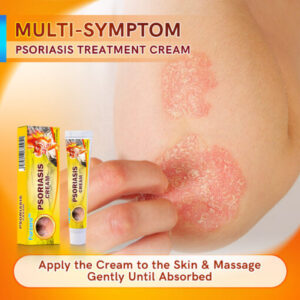 Furzero™ PsoriaCare Psoriasis Treatment Cream