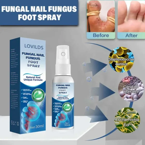 LOVILDS™ Medical Grade Nail Fungus Foot Strengthening Spray