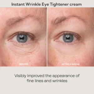 Lovilds™ Instant Wrinkle Eye Tightener cream