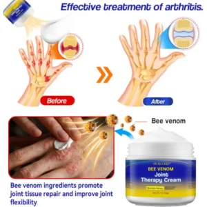 Ourlyard™ Bee Venom Joint Therapy Cream: Relieve stiffness and swelling