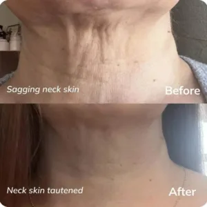 Tighten & Lift Neck Cream