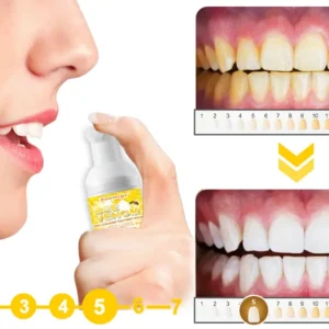 Zoencgz™ Bee Venom Oral Cleansing Treatment Mousse