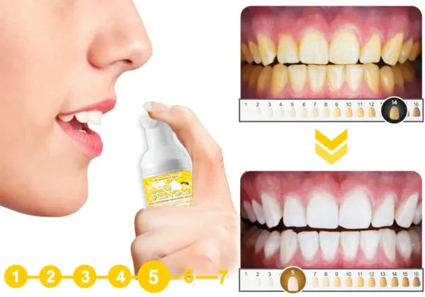 Zoencgz™ Bee Venom Oral Cleansing Treatment Mousse