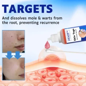 AEXZR™ Skin Tags Removal Serum