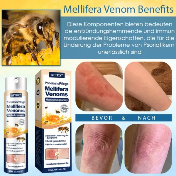 ATTDX™ PsoriasisPflege Mellifera Venoms Hautheilungsspray