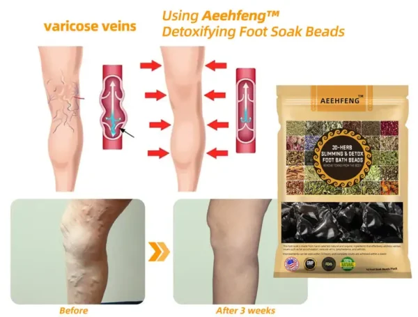 Aeehfeng™ 30-Herb Slimming & Detox Foot