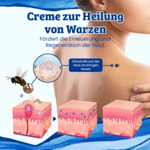 Ceoerty™ CurSkin Bienengift Schuppenflechte & Warzenheilungscreme