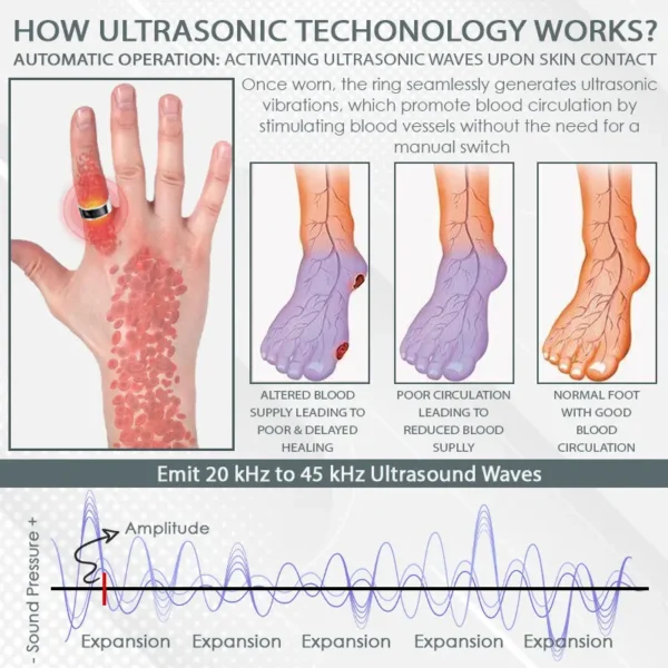 CircuWave™ Ultrasonic VascularSupport Ring