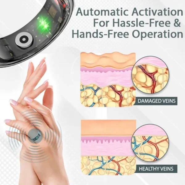 CircuWave™ Ultrasonic VascularSupport Ring