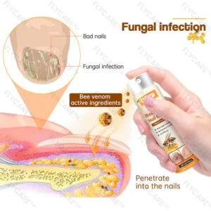 FLYCARE™ Bee Venom Nail Fungus Spray