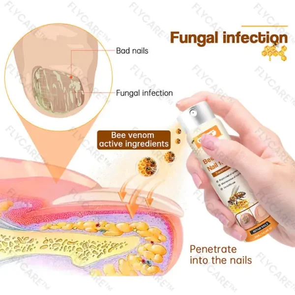 FLYCARE™ Bee Venom Nail Fungus Spray