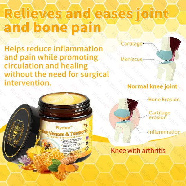 FLYCARE™ Bee Venom & Turmeric Arthritis Treatment Cream