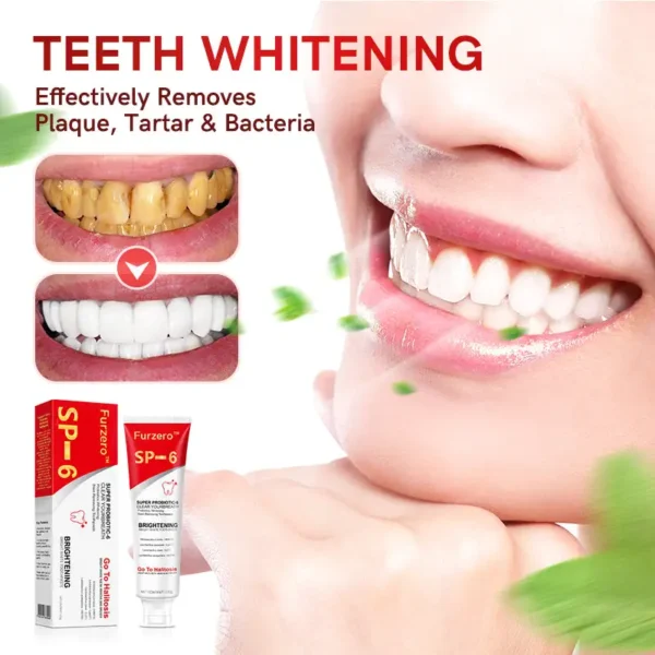 Furzero™ Canadian SP-6 Probiotic Ultra Whitening Toothpaste