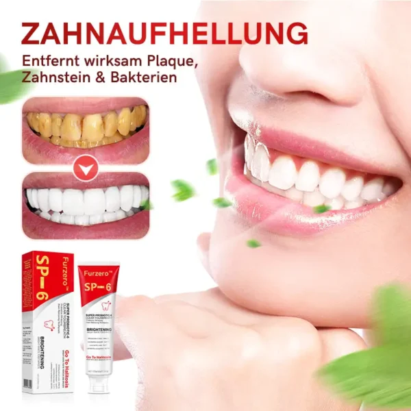 Furzero™ SP-6 Probiotic Ultra Whitening Zahnpasta