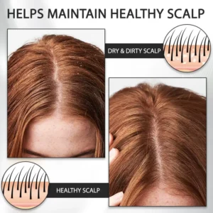 LOVILDS™ Alopecia Recovery Hair Booster Roll-On