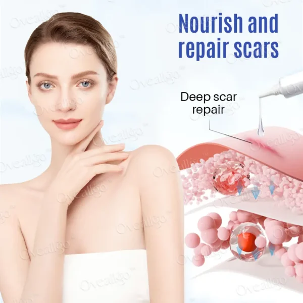 Oveallgo™ SilkScar Scar Treatment & Skin Repair Serum