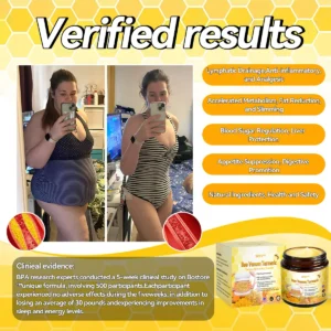 SPZV™ Bee Venom Turmeric Detox Slimming Cream