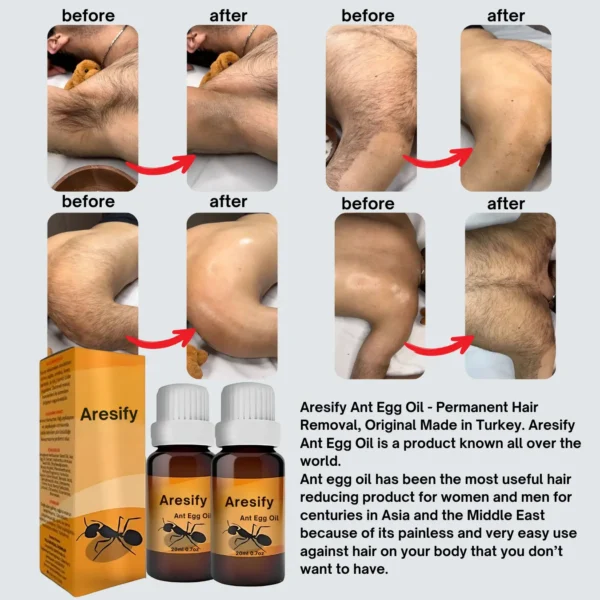 Aresify® ANT EGG OIL