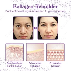 Ceoerty™ GlowEyes Kollagen-Augencreme