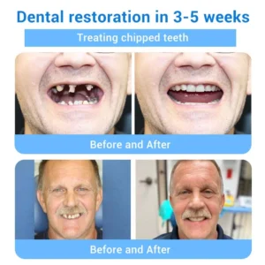 Doctia™ Teeth Restoration Mineral Powder