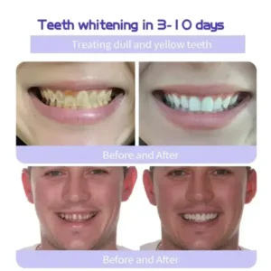 GarageLine™ Teeth Restoration Mineral Powder