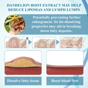 Lovilds™ LumpsClear Lymph Say Goodbye to Lipomas and Swelling