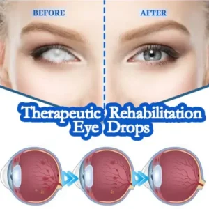 THONESR™ Vision recovery eye drops