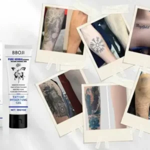 Tattoo Removal Cream: Fast, Painless & Scar-Free Tattoo Erasure