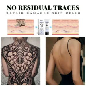 Tattoo Removal Cream: Fast, Painless & Scar-Free Tattoo Erasure