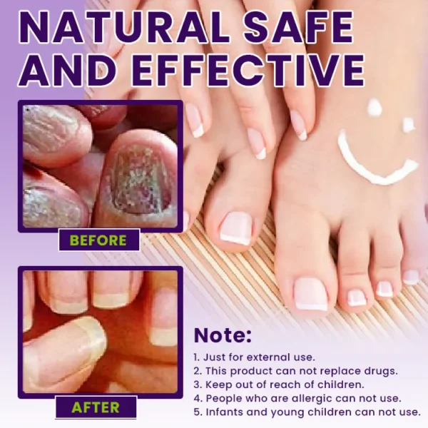 LIMETOW™ Multi-Purpose Nail Repair - Image 4